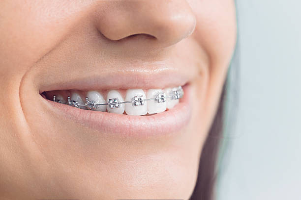 Best Traditional Braces  in Kingsford, MI